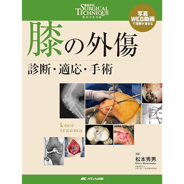 体験する手外科: 珠玉の症例編 (第4巻) | 鳥谷部荘八 |本 | 通販